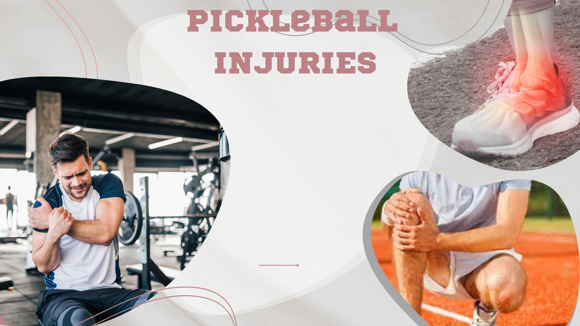 5 Most Common Pickleball Injuries; How to Protect Them